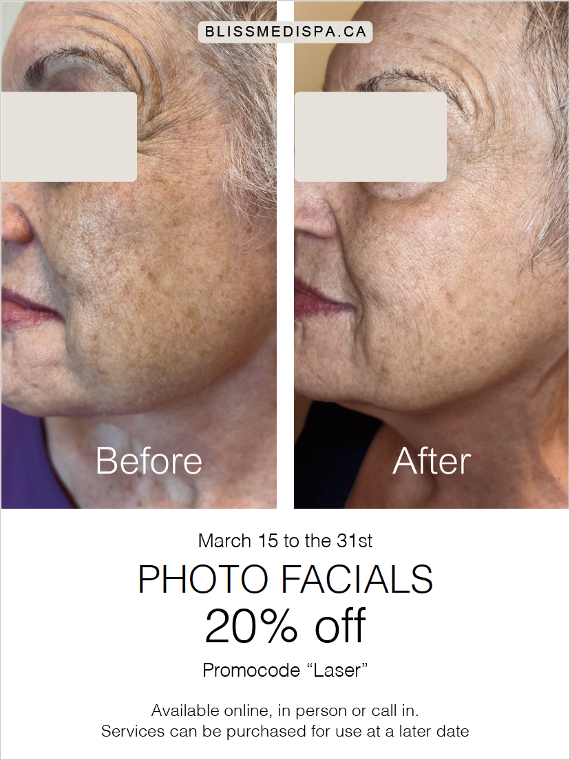 Photo Rejuvenation Sale