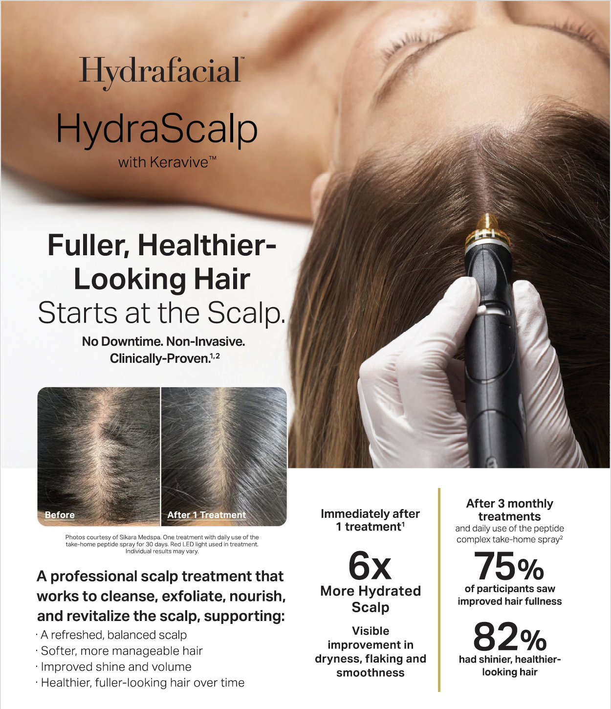 Hydracalp