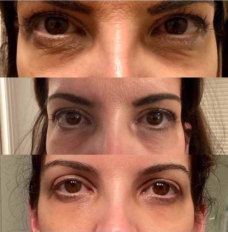 before & after